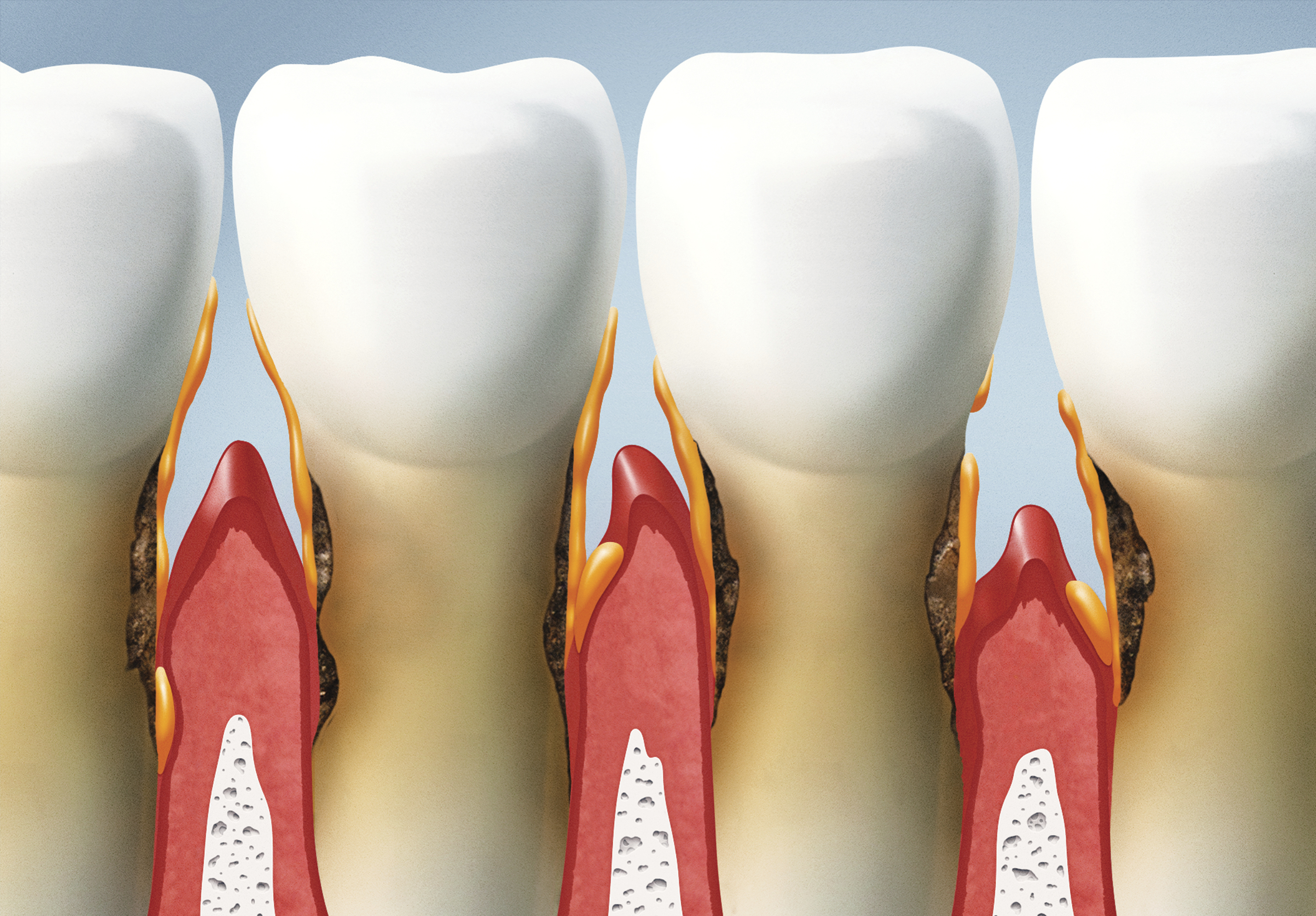 periodontologija